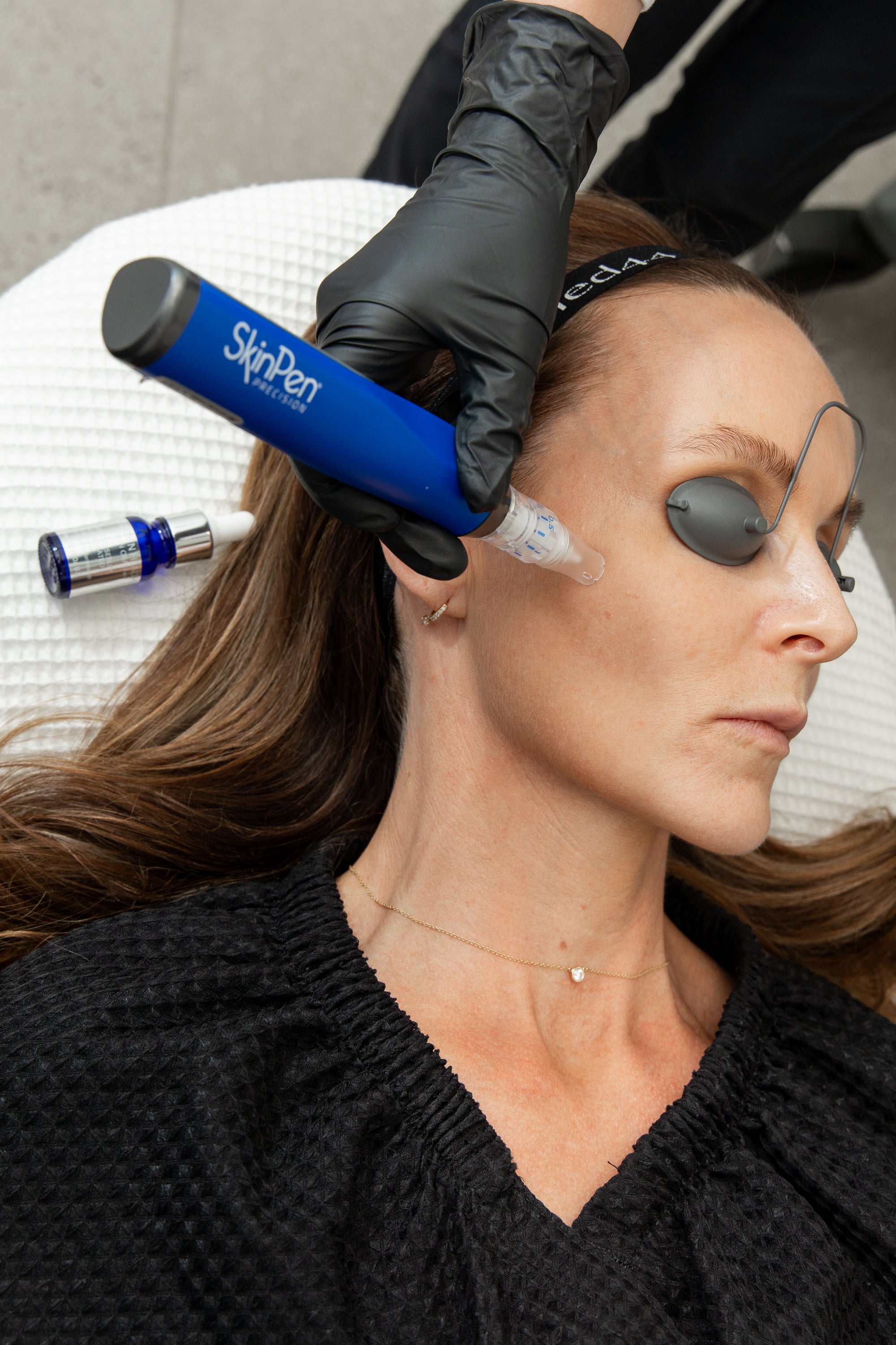 Smooth, Tighten, and Brighten with SkinPen® Microneedling